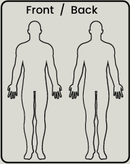 Body diagram for clicking on